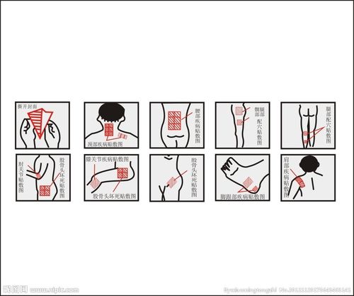 膏药贴敷图图片
