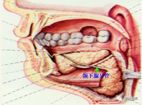 颌下腺大小约2.0 × 3.4 cm,呈三角型或类圆型.