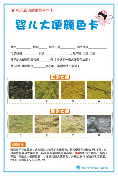 上海市胆道闭锁筛查项目中使用的色卡借鉴的是英国新生儿黄疸教育项目