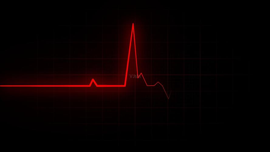 心电图心率跳动循环带通道