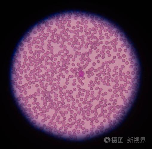 红血细胞显微镜在医学背景概念下