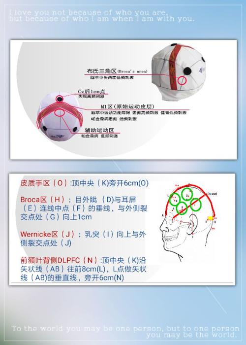 一周南京行的收获——记"对经颅磁技术的学习"