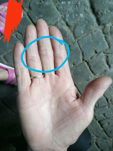 4)如果四指上有很多的竖纹也说明呼吸系统不好.