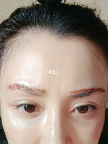激光洗眉_口罩_帽子_美妆_医美整形