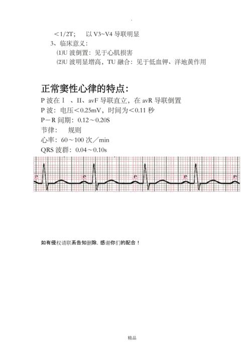 正常心电图波形特点