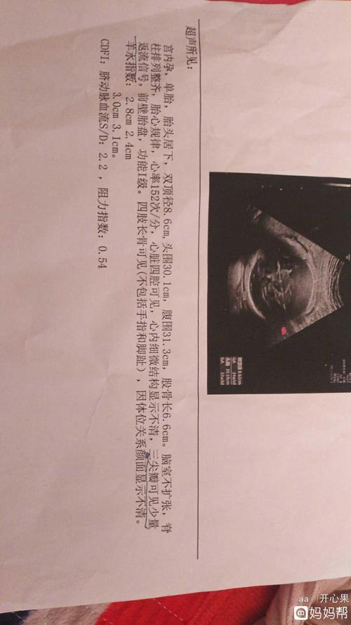 三尖瓣少量反流信号