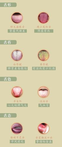 舌头出现这种颜色,斑点,警惕心脑血管疾病,教你望舌识