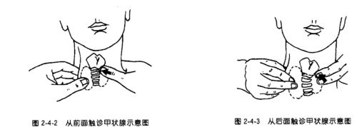甲状腺检查