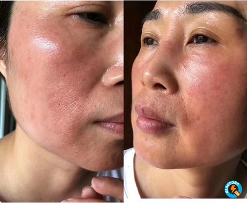 敏感肌肤擦啥化妆品呀