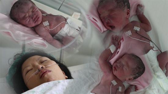 三胞胎带来重重风险《生命缘》讲述生命奇迹
