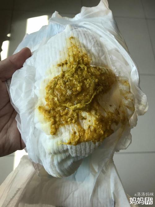 宝宝拉蛋花汤似的大便怎么办?(有图慎入)
