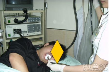 胃病检查除了胃镜还有其它方法吗