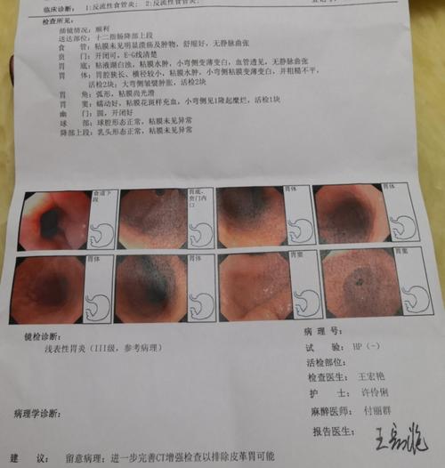 搞明白"慢性萎缩性胃炎