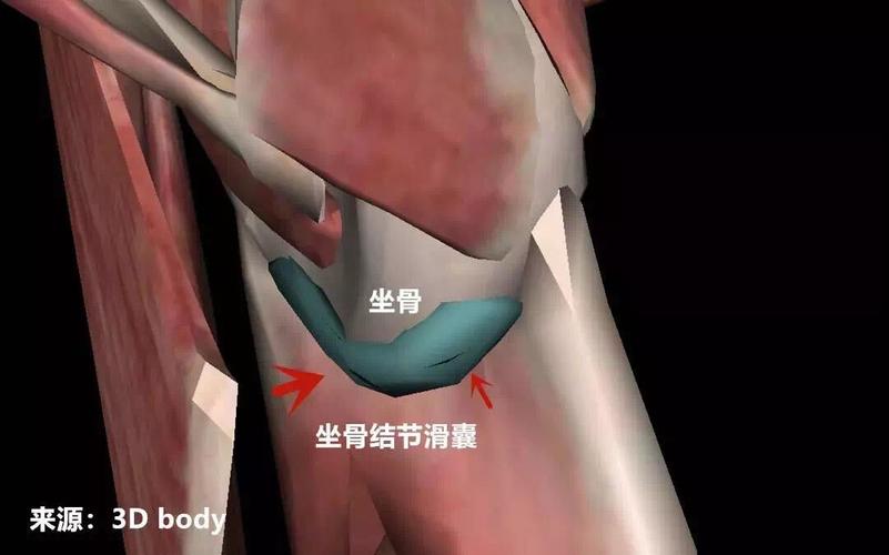 坐骨结节滑囊炎又称坐骨结节囊肿,是一种常见的滑囊炎,好发于体质较弱