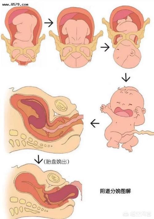 胎儿是否顺产,骨产道水平和软产道的扩张水平是先决条件.