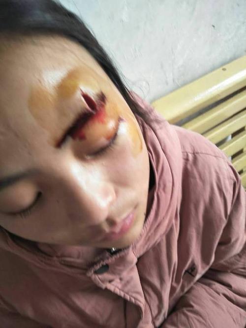 谢谢! 高三学生在教室里打架,一方受伤(眉毛上下伤口三公分,眼角
