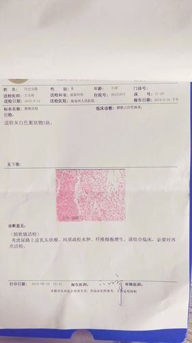 膀胱占位性病变