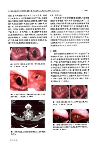 喉挫伤致环杓关节脱位诊治.pdf