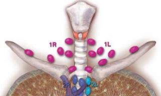图文总结:纵隔淋巴结的分区