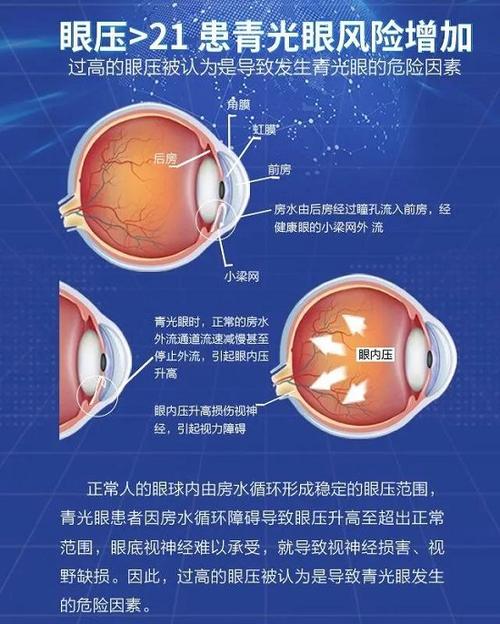 世界青光眼周|视神经一张照,青光眼早知道,眼健康检查