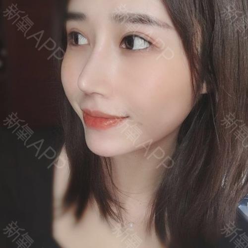 鼻子与脸型的关系!你知道多少?11566圆脸_圈子-新氧美容整形