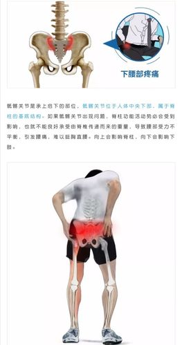 腰臀腿总疼,很可能是"骶髂关节"有问题!