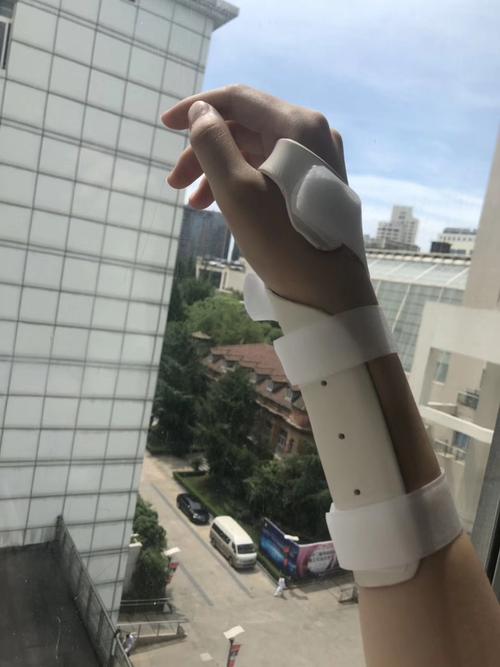 养狗养到打石膏