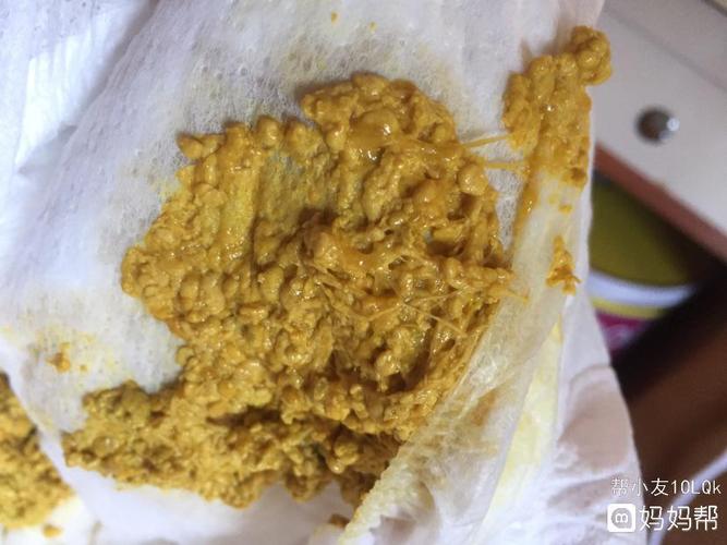 婴儿便便带拉丝粘液(有图)