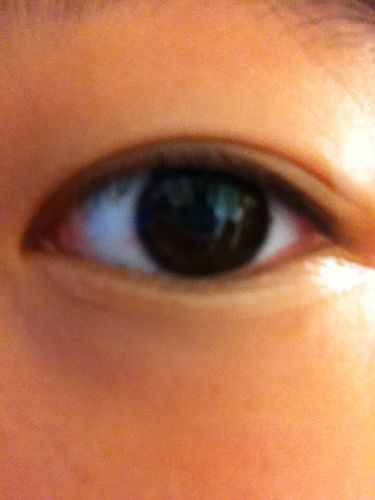 眼睛经常红是怎么回事?