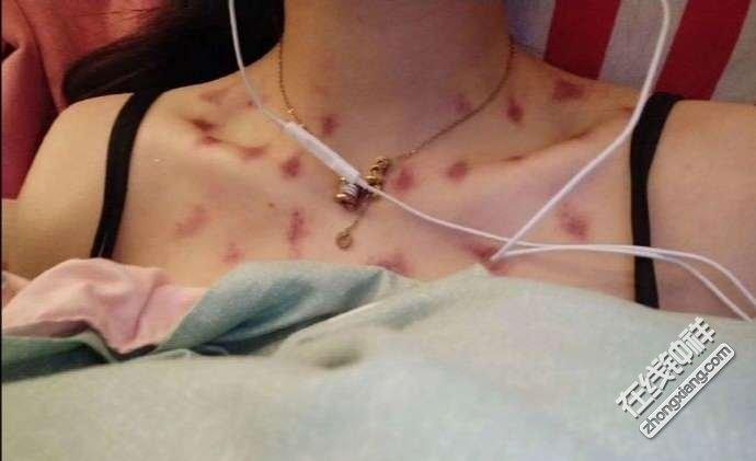 看看这个女生的锁骨一大片红印子还非说不是吻痕我咋不太信呢