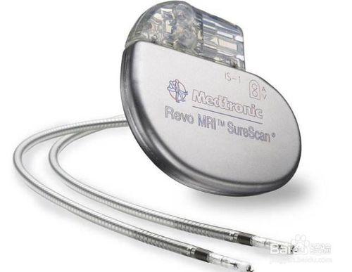 装上心脏起搏器这些事不可做