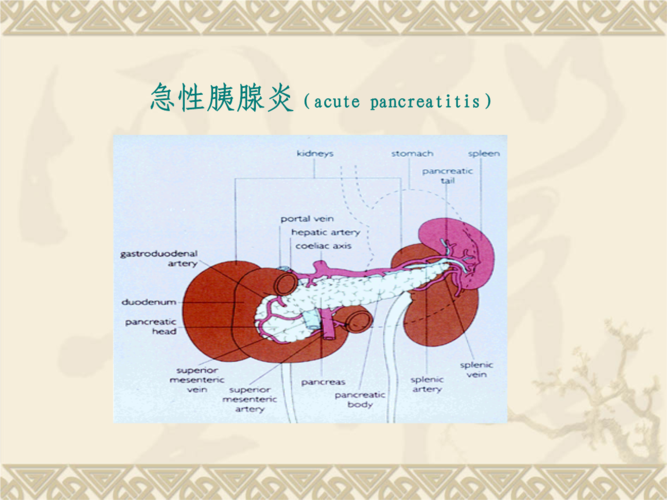 (精编)【医学课件大全】急性胰腺炎(acute pancreatitis)教学课件.ppt