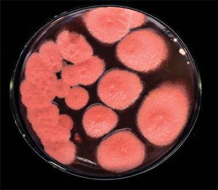 红曲霉长咋样?它是好气性微生物吗?