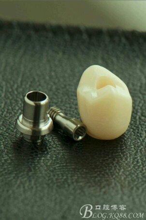 种植体个性化基台加工品质的辨别