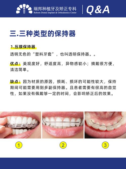 深圳牙齿矫正 | 戴好保持器避免二次矫正_保持器_清洁_牙齿矫正_牙套