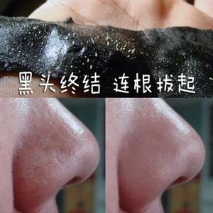 鼻贴去黑头男图片