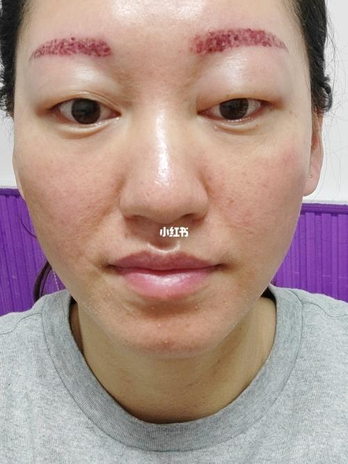 医疗美容自由行热门攻略_医疗美容_一字眉_超皮秒洗眉_美妆_医美整形