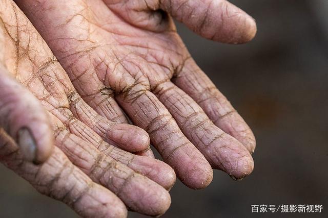 山村大嫂一双手震撼人心,她用这双长满厚茧,变形裂口