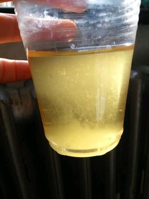 孕妇尿里放盐的变化晨尿加盐看男女的图片