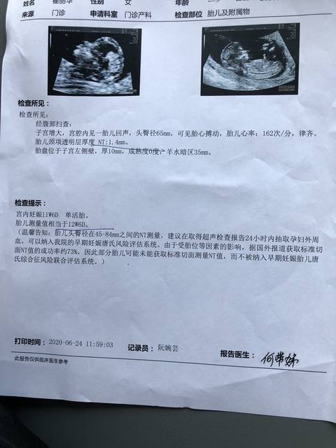 nt检查会在11周~13周,因为患唐氏症的胎儿会有皮下积水的情况出现,此