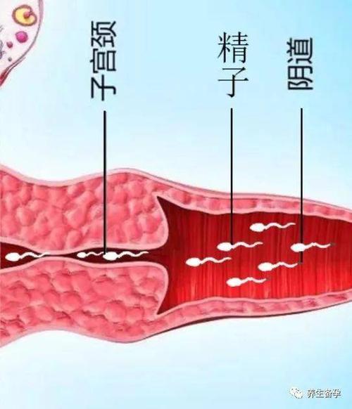 我画了三张简单的图,大家应该一看就明白了哪个宫颈的位置会影响怀孕