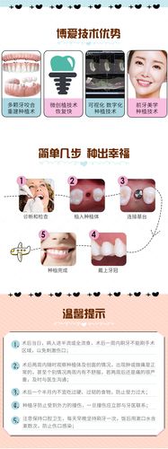 种植牙 成都瑞士士卓曼瑞锆种植牙 坚固耐用 下单即送专用大礼包