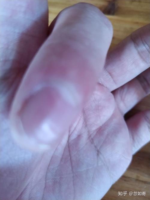 手指被门夹到飙泪是种怎样的体验?