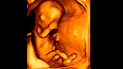 四维彩超看胎儿性别-多少周能看出男女