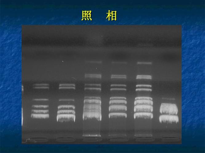 生物化学经典实验dna琼脂糖凝胶电泳的原理,步骤,试剂配制,结果分析