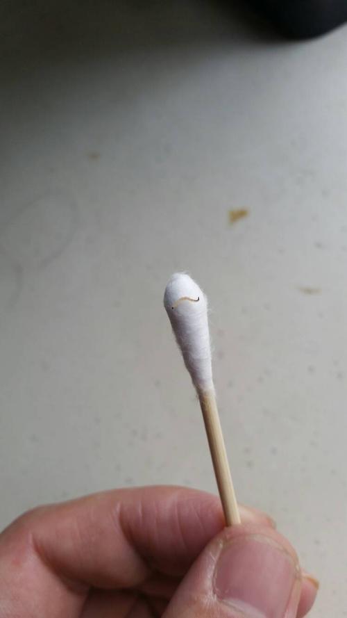 最近在家里的洗手盆里发现白色透明的小线虫!请问这是