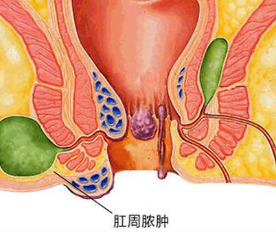 肛门周围肿胀疼痛是怎么回事