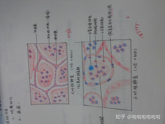 病理学切片红蓝铅笔画