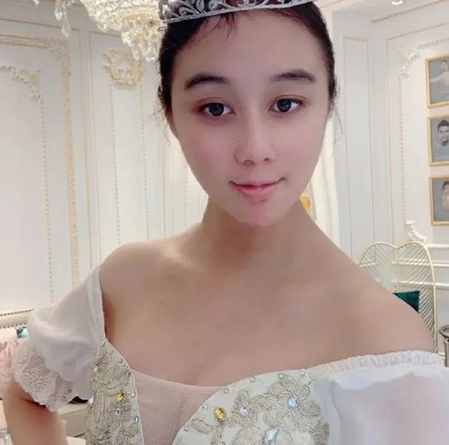 赌王幼女何超欣爆肥大腿肥硕肿得像胖天鹅双眼无神越长越怪