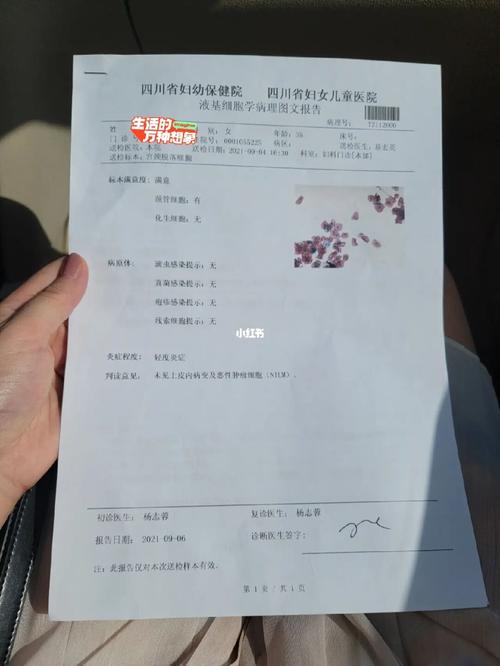 hpv_宫颈癌_妇科_运动_b超_宫颈癌筛查_医疗健康_医疗健康其他